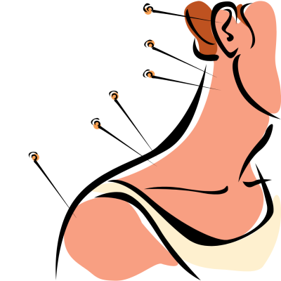 Acupuntura no Controle da Dor: Alívio Natural e Eficaz